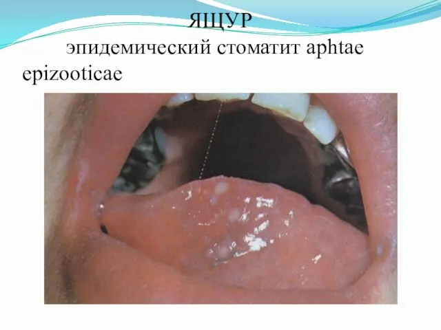 ЯЩУР эпидемический стоматит aphtae epizooticae