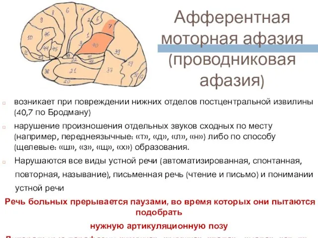 возникает при повреждении нижних отделов постцентральной извилины (40,7 по Бродману)