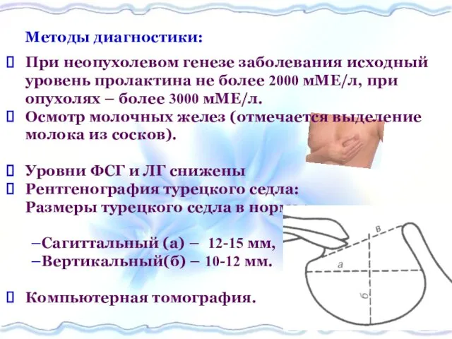 Методы диагностики: При неопухолевом генезе заболевания исходный уровень пролактина не более 2000 мМЕ/л,