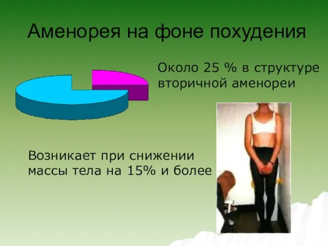 Аменорея на фоне похудения Около 25 % в структуре вторичной аменореи Возникает при