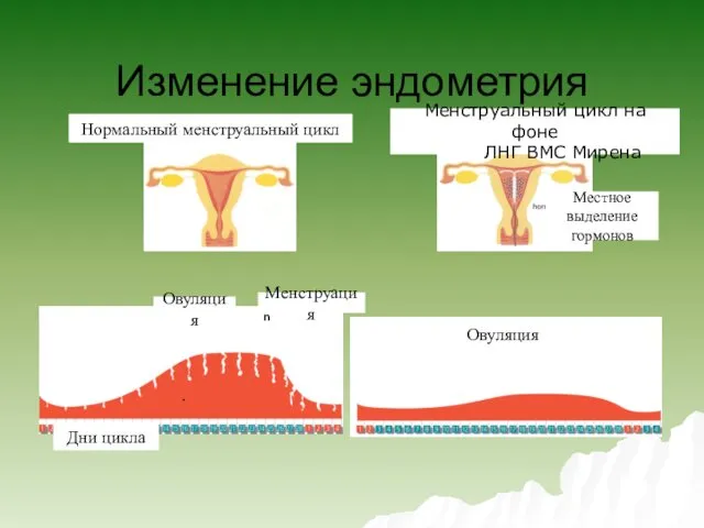 Изменение эндометрия Days of cycle Ovulation Ovulation Menstruation Нормальный менструальный цикл Менструальный цикл