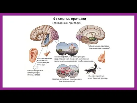 Фокальные припадки