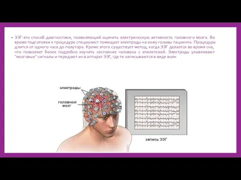 ЭЭГ-это способ диагностики, позволяющий оценить электрическую активность головного мозга. Во время подготовки к