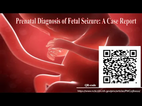 Prenatal Diagnosis of Fetal Seizure: A Case Report https://www.ncbi.nlm.nih.gov/pmc/articles/PMC2580021/ QR-code