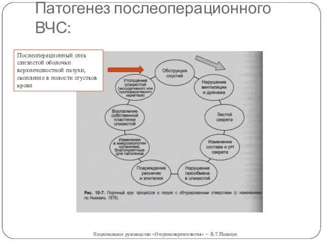 Патогенез послеоперационного ВЧС: Послеоперационный отек слизистой оболочки верхнечелюстной пазухи, скопление в полости сгустков