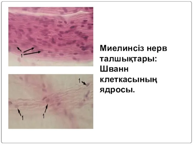 Миелинсіз нерв талшықтары: Шванн клеткасының ядросы.
