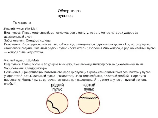 Обзор типов пульсов По частоте Редкий пульс (Чи-Май) Вид пульса.