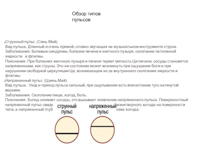 Обзор типов пульсов Струнный пульс (Сянь-Май) Вид пульса. Длинный и