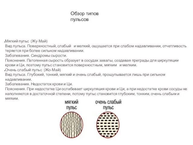 Обзор типов пульсов Мягкий пульс (Жу-Май) Вид пульса. Поверхностный, слабый