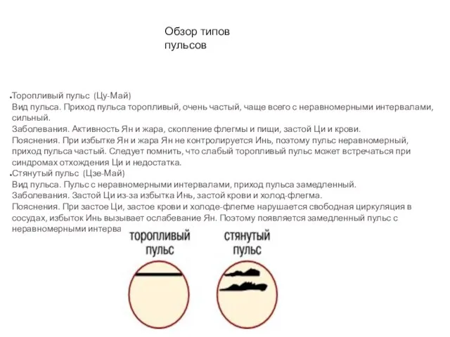 Обзор типов пульсов Торопливый пульс (Цу-Май) Вид пульса. Приход пульса