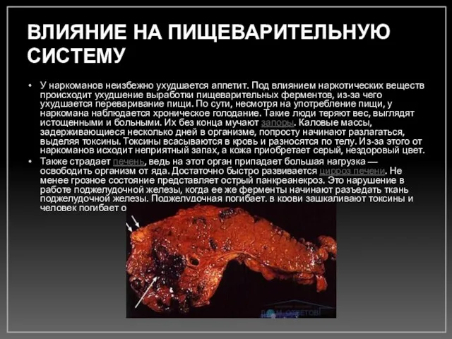 ВЛИЯНИЕ НА ПИЩЕВАРИТЕЛЬНУЮ СИСТЕМУ У наркоманов неизбежно ухудшается аппетит. Под