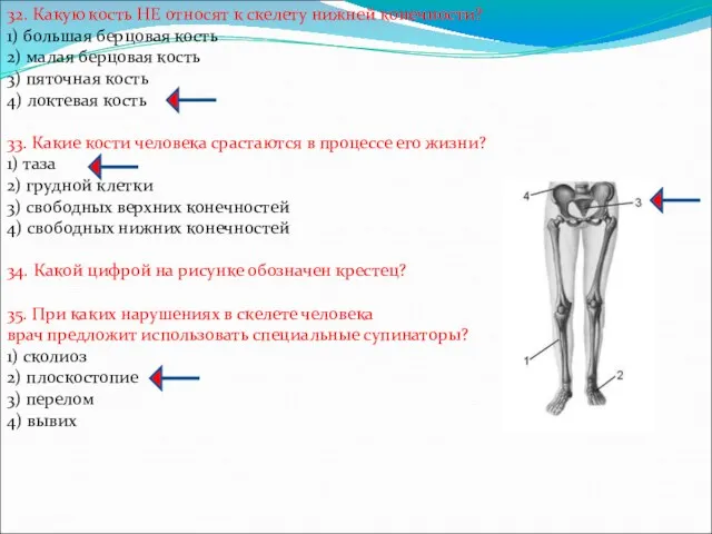 32. Какую кость НЕ относят к скелету нижней конечности? 1)