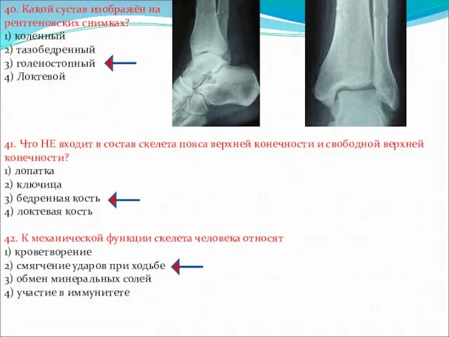 40. Какой сустав изображён на рентгеновских снимках? 1) коленный 2)