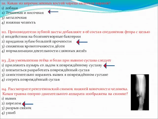 111. Какая из перечисленных костей черепа является парной? 1) лобная