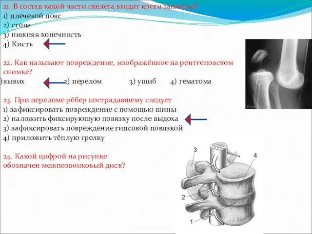 21. В состав какой части скелета входят кости запястья? 1)