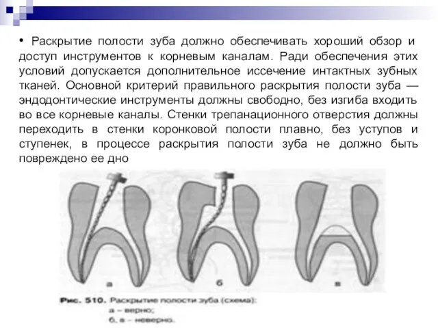• Раскрытие полости зуба должно обеспечивать хороший обзор и доступ