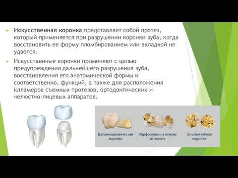 Искусственная коронка представляет собой протез, который применяется при разрушении коронки