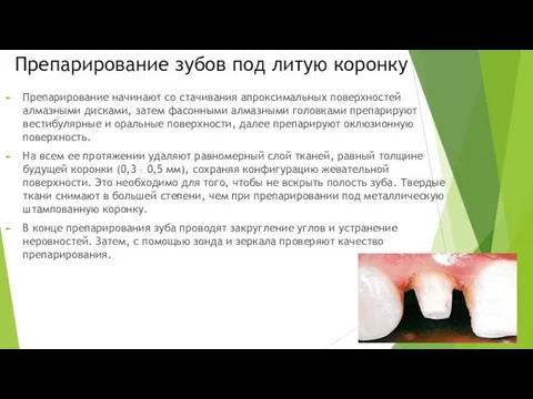 Препарирование зубов под литую коронку Препарирование начинают со стачивания апроксимальных