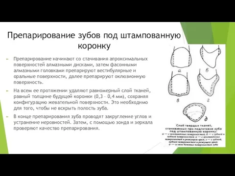 Препарирование зубов под штампованную коронку Препарирование начинают со стачивания апроксимальных