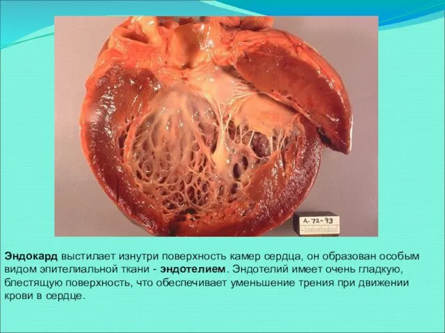 Эндокард выстилает изнутри поверхность камер сердца, он образован особым видом эпителиальной ткани -
