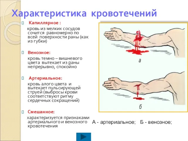 Характеристика кровотечений Капиллярное : кровь из мелких сосудов сочится равномерно