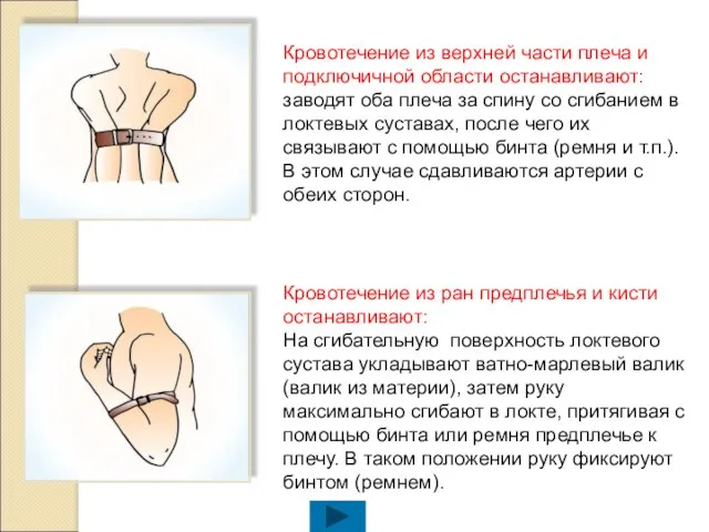 Кровотечение из верхней части плеча и подключичной области останавливают: заводят