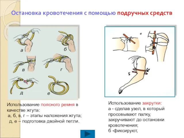 Остановка кровотечения с помощью подручных средств Использование поясного ремня в