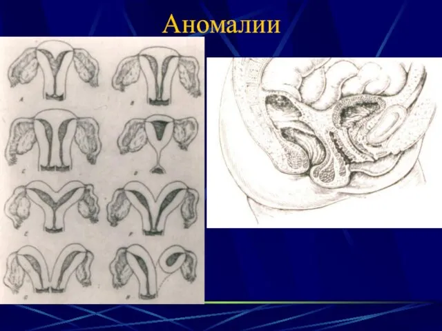 Аномалии