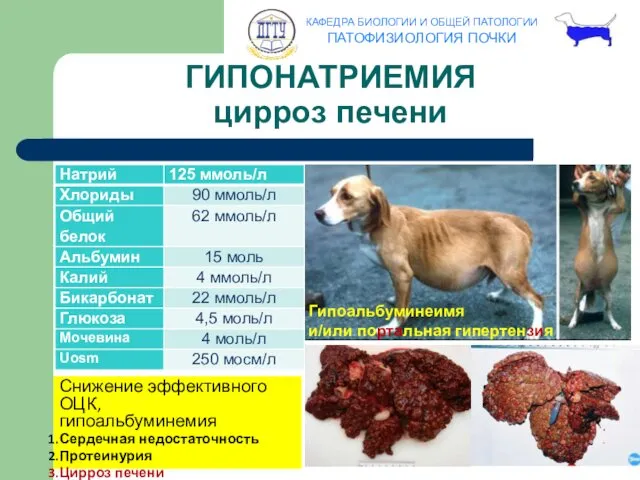 ГИПОНАТРИЕМИЯ цирроз печени Снижение эффективного ОЦК, гипоальбуминемия Сердечная недостаточность Протеинурия Цирроз печени Гипоальбуминеимя и/или портальная гипертензия