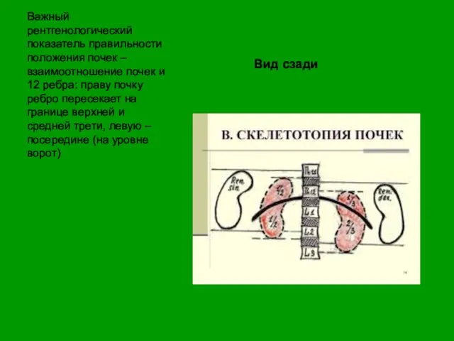 Вид сзади Важный рентгенологический показатель правильности положения почек –взаимоотношение почек