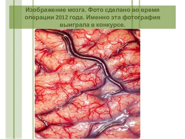 Изображение мозга. Фото сделано во время операции 2012 года. Именно эта фотография выиграла в конкурсе.