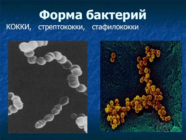 Форма бактерий КОККИ, стрептококки, стафилококки