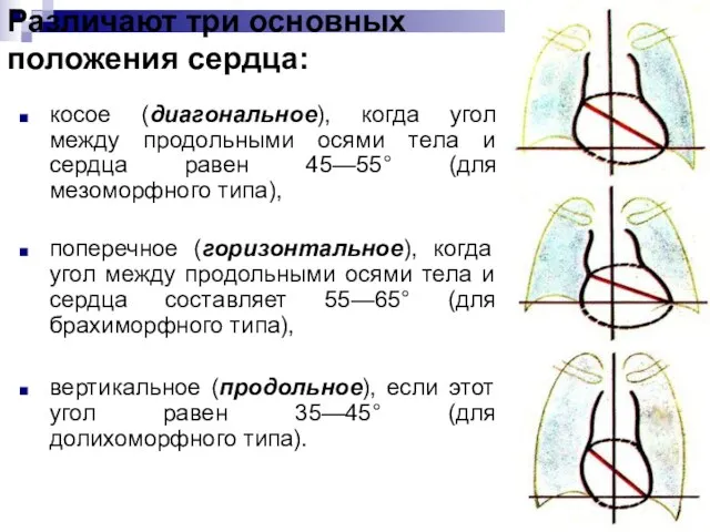 Различают три основных положения сердца: косое (диагональное), когда угол между