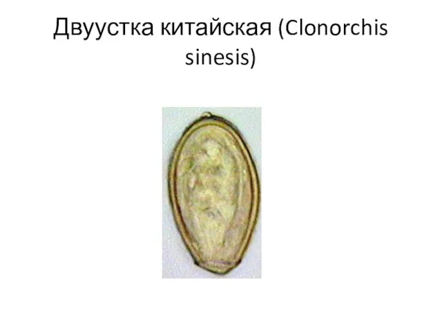 Двуустка китайская (Clonorchis sinesis)