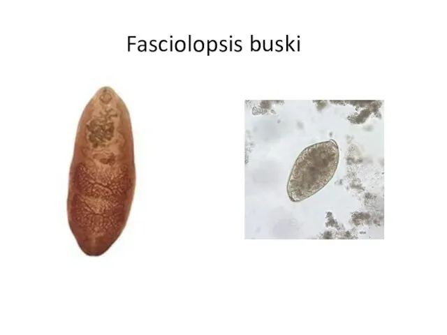 Fasciolopsis buski