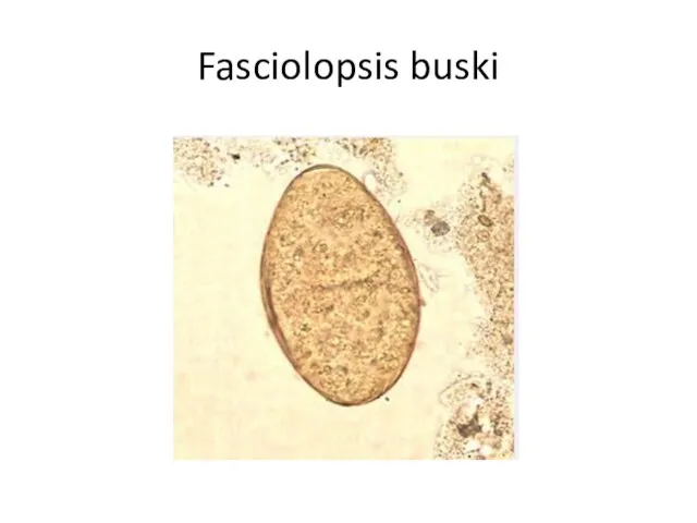 Fasciolopsis buski