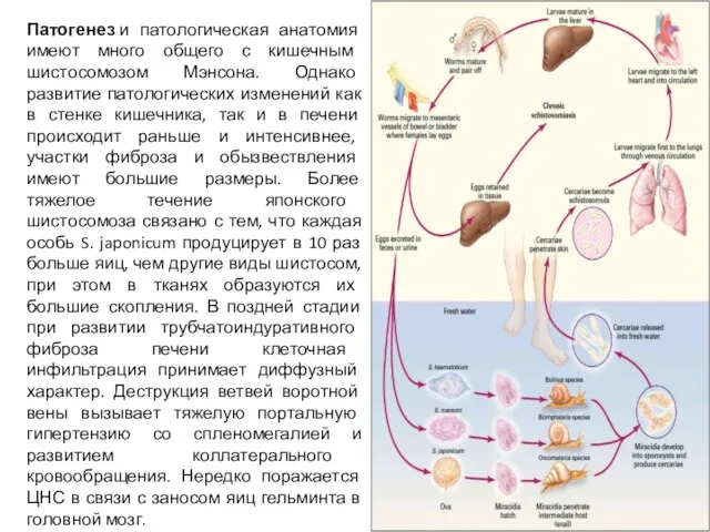 Патогенез и патологическая анатомия имеют много общего с кишечным шистосомозом