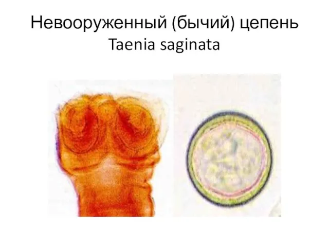 Невооруженный (бычий) цепень Taenia saginata