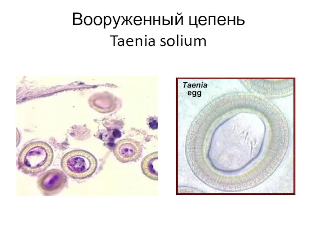 Вооруженный цепень Taenia solium