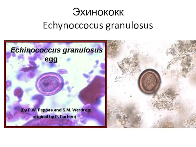 Эхинококк Echynoccocus granulosus