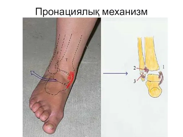 Пронациялық механизм