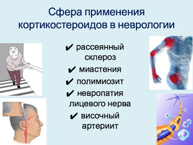 Сфера применения кортикостероидов в неврологии рассеянный склероз миастения полимиозит невропатия лицевого нерва височный артериит