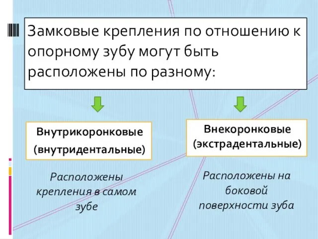 Внутрикоронковые (внутридентальные) Замковые крепления по отношению к опорному зубу могут