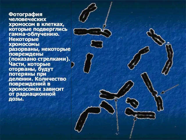 Фотография человеческих хромосом в клетках, которые подверглись гамма-облучению. Некоторые хромосомы