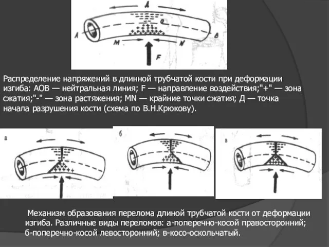 Распределение напряжений в длинной трубчатой кости при деформации изгиба: АОВ