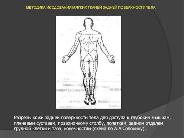 МЕТОДИКА ИССДОВАНИЯ МЯГКИХ ТКАНЕЙ ЗАДНЕЙ ПОВЕРХНОСТИ ТЕЛА Разрезы кожи задней