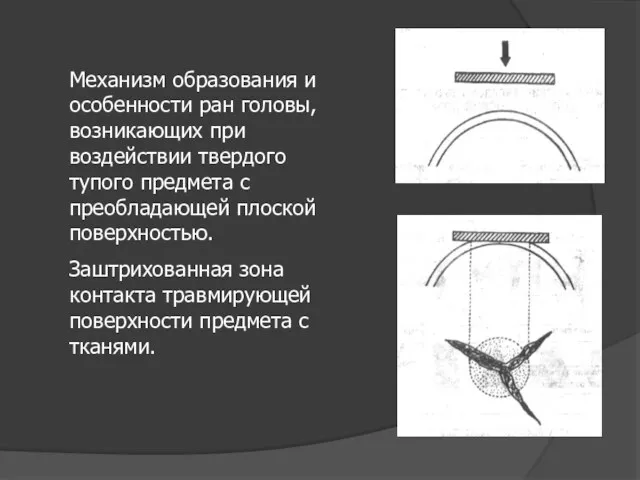 Механизм образования и особенности ран головы, возникающих при воздействии твердого