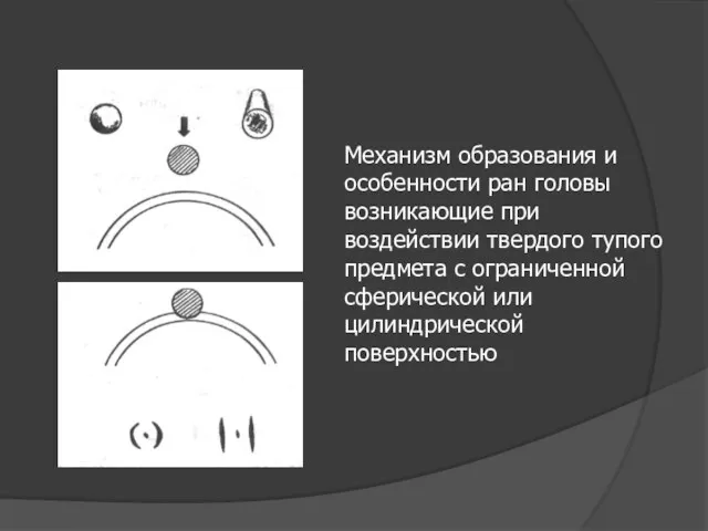 Механизм образования и особенности ран головы возникающие при воздействии твердого