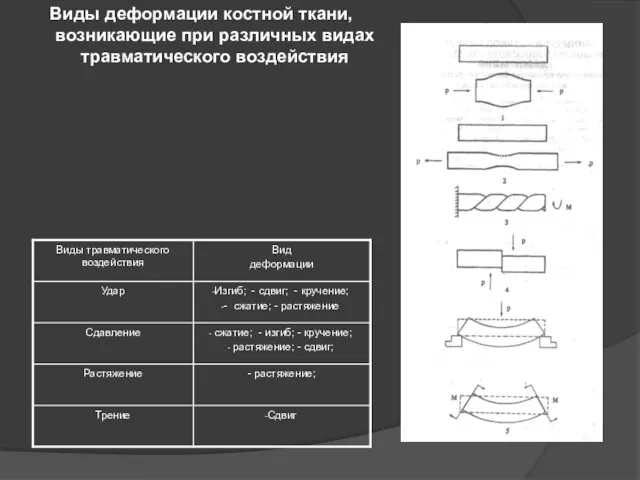 Виды деформации костной ткани, возникающие при различных видах травматического воздействия