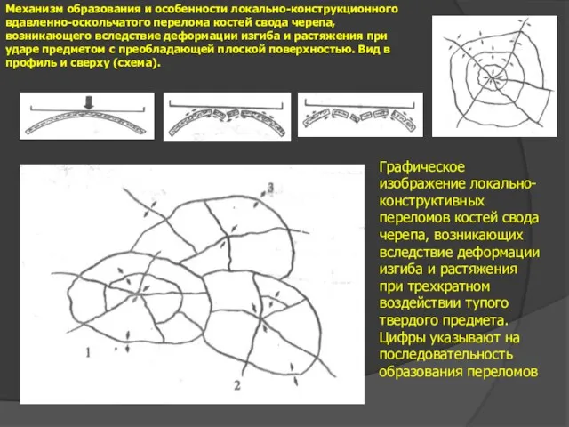 Механизм образования и особенности локально-конструкционного вдавленно-оскольчатого перелома костей свода черепа,